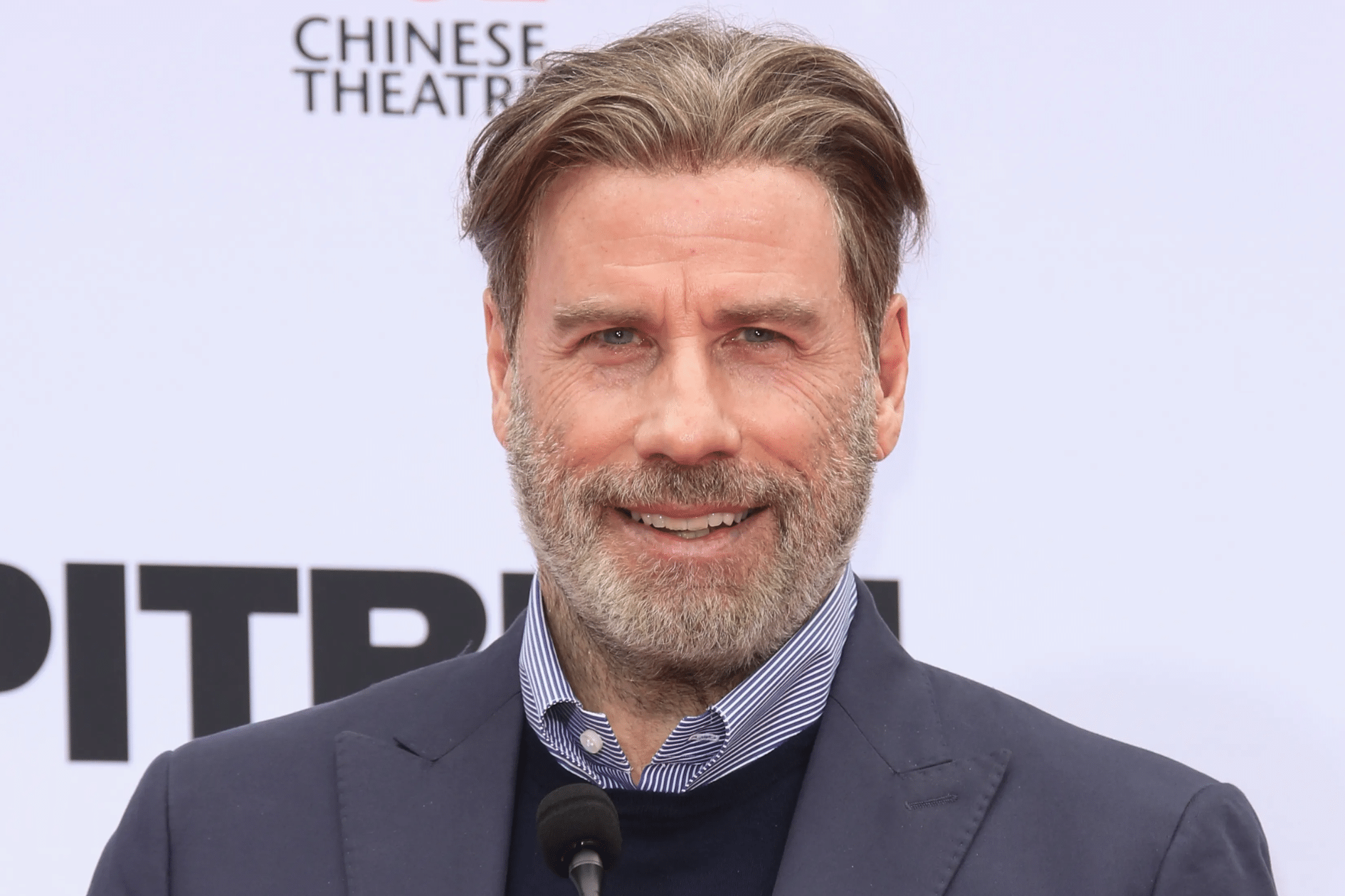 John Travolta pós transplante capilar