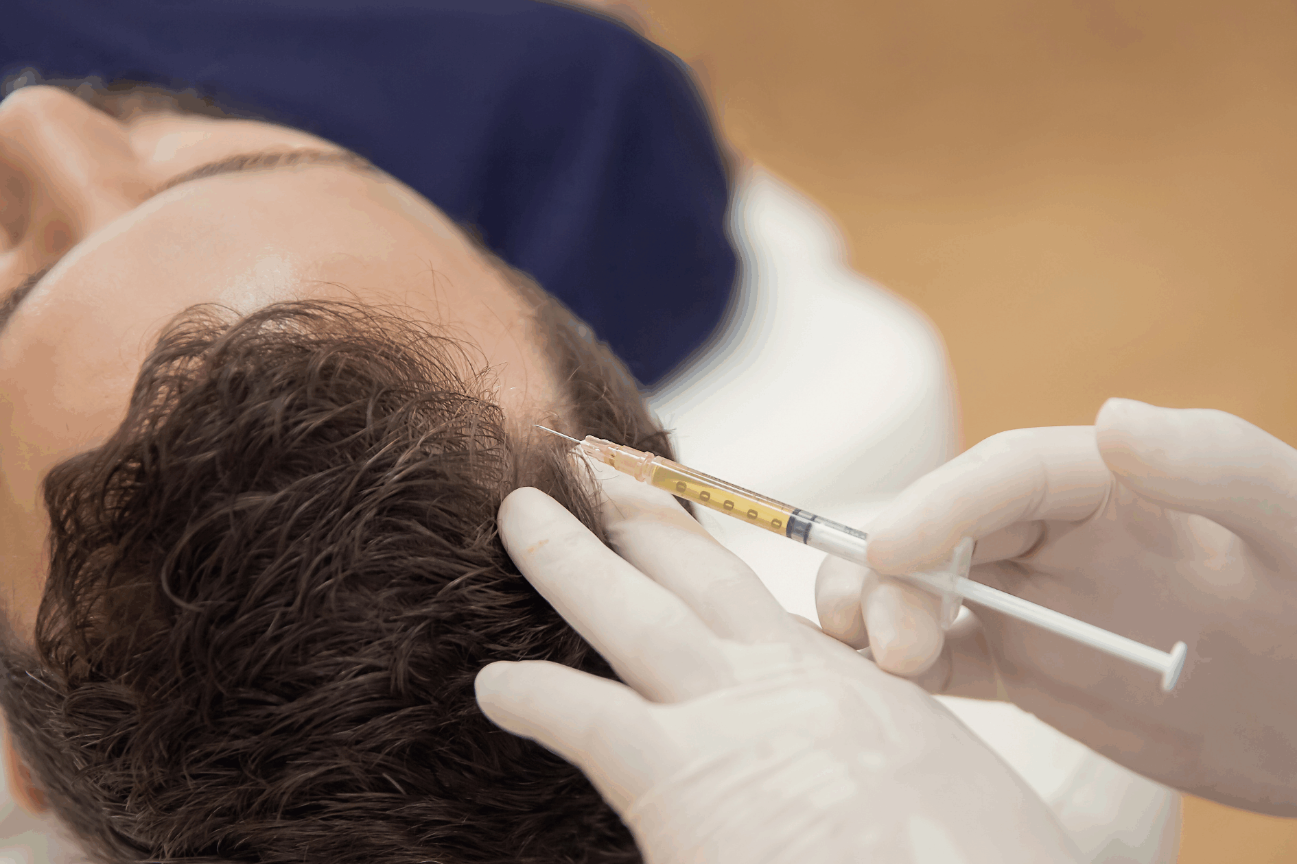 Paciente utilizando técnica de Prevenção de Queda Capilar