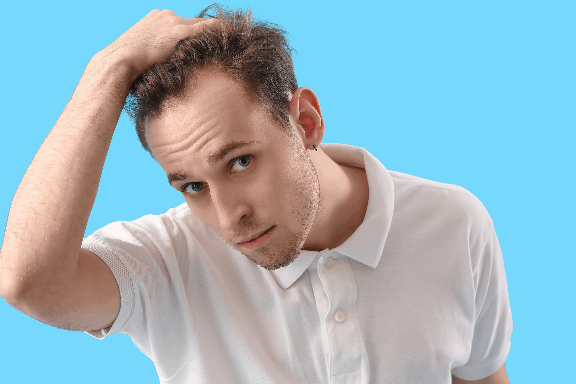 Homem se olhando no espelho e pensando se ele é candidato ideal para realizar Transplante Capilar