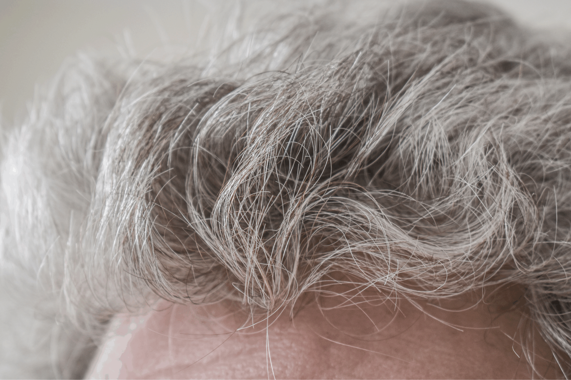 Como Reverter Cabelos Brancos com Vitamina B5